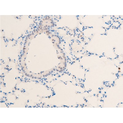 Phospho-c-Myc (Thr58) Antibody - AF3055 at 1/100 staining mouse lung tissue sections by IHC-P.