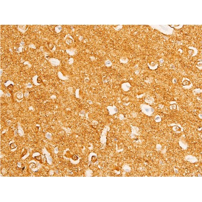 Phospho-c-Myc (Thr58) Antibody - AF3055 at 1/100 staining human brain tissue sections by IHC-P.