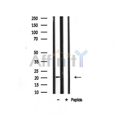 JM4 Antibody - Western blot analysis of JM4 expression in mouse brain lysate.