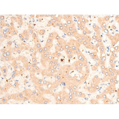 TGF beta 1 Antibody - AF1027 at 1/100 staining human liver tissue sections by IHC-P.