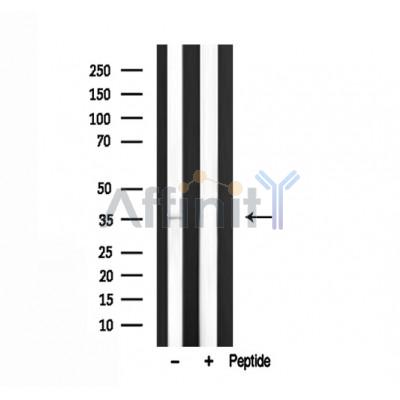 TACD2 Antibody - Western blot analysis of TACD2 expression in mouse muscle lysate.