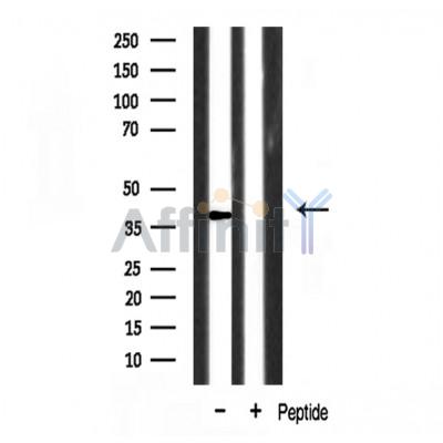 NR2F6 Antibody - Western blot analysis of extracts from rat spleen, using NR2F6 antibody.