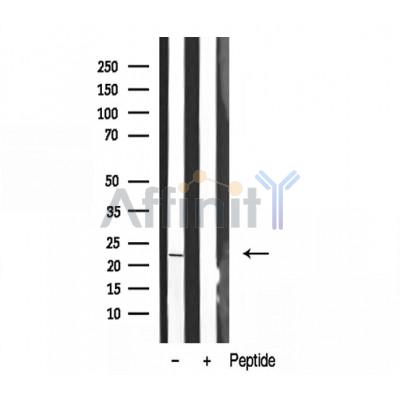CSRP1 Antibody - Western blot analysis of extracts from mouse Brian, using CRP1 antibody.