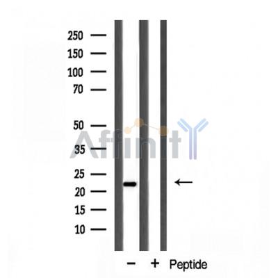 PPIF Antibody - Western blot analysis of extracts from mouse Brian cells using PPIF antibody.