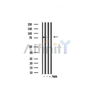 AKAP8 Antibody - Western blot analysis of extracts from various samples, using AKAP8 Antibody.