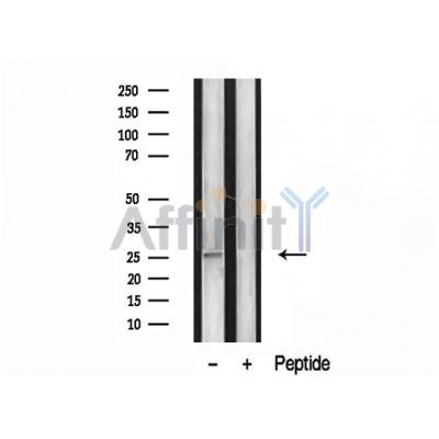Ephrin A5 Antibody - Western blot analysis of extracts from mouse brain, using EFNA5 antibody.