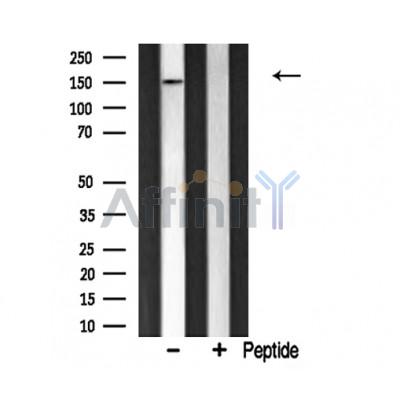 CAF1A Antibody - Western blot analysis of CAF1A  expression in mouse brain lysate.