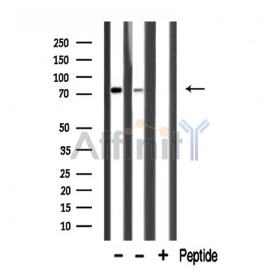 HLX1 Antibody - Western blot analysis of extracts from various samples, using HLX1 Antibody.