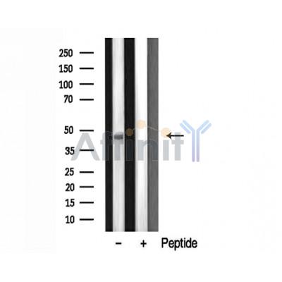 VPS72 Antibody - Western blot analysis on mouse brain lysates using VPS72 Antibody.