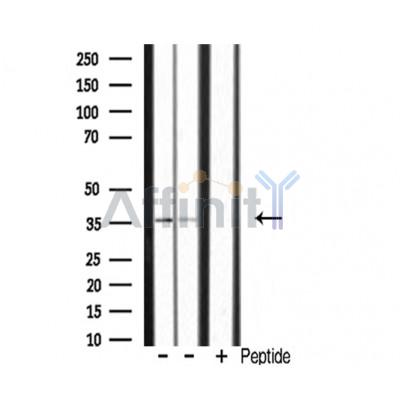 POU4F3 Antibody - Western blot analysis of extracts from various samples, using POU4F3 Antibody.