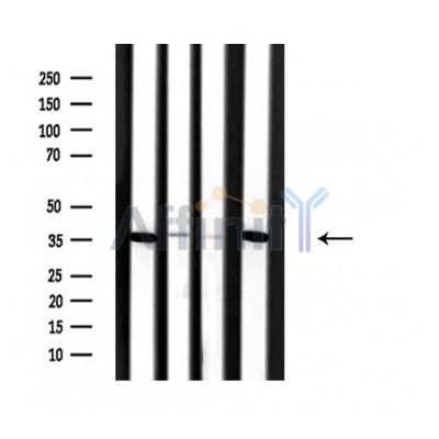 SLC25A31 Antibody - Western blot analysis of extracts from various samples, using SLC25A31 Antibody.