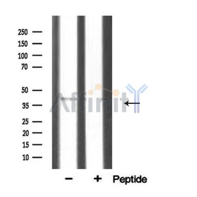 SGCA Antibody - Western blot analysis of extracts from mouse brian, using SGCA antibody.
