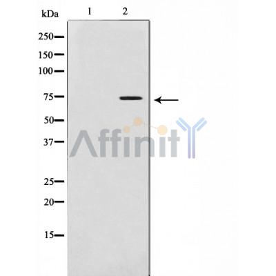 MMP2 Antibody - Western blot analysis of MMP 2 expression in LOVO cells.