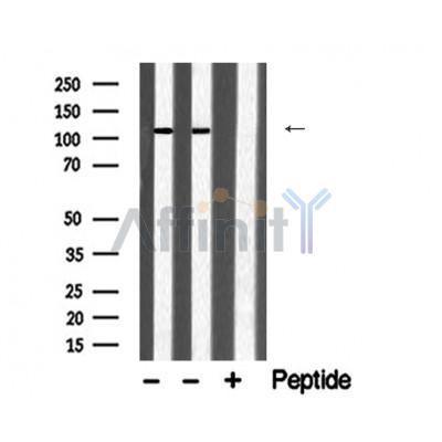 Hexokinase 1 Antibody - Western blot analysis of extracts from various samples, using HK1 Antibody.