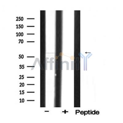MMP3 Antibody - Western blot analysis of rat brain lysates, using MMP3 antibody.