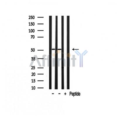 pan-AKT1/2/3 Antibody - Western blot analysis of extracts from various samples, using AKT1/2/3 Antibody.