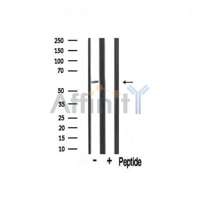 TRIM16 Antibody - Western blot analysis of TRIM16 Antibody expression in Mouse muscle tissue lysates.