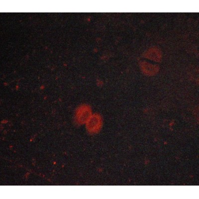Phospho-JAK1 (Tyr1022)[Tyr1034] Antibody - AF2012 staining lovo cells by ICC/IF.