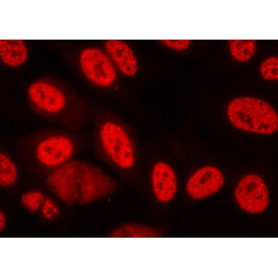 Phospho-Chk1 (Ser280) Antibody - AF2014 staining lovo cells by ICC/IF.