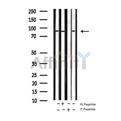 Phospho-IKK beta (Tyr199) Antibody - Western blot analysis of Phospho-IKK beta (Tyr199) expression in various lysates.