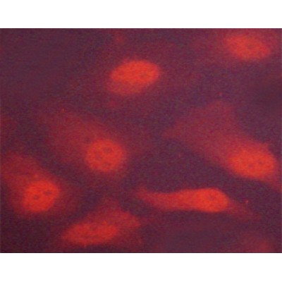 Phospho-Chk2 (Thr383) Antibody - AF3034 staining Hela cells by ICC/IF.