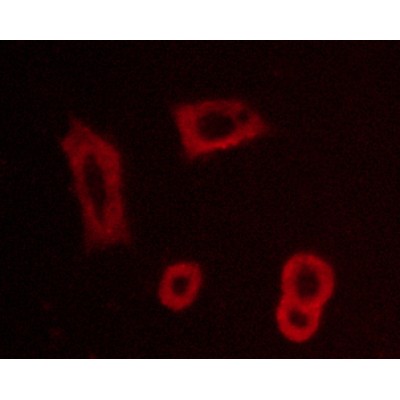Phospho-EGFR (Tyr992)[Tyr1016] Antibody - AF3043 staining BT-20 cells by ICC/IF.
