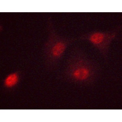 Phospho-c-Myc (Ser62) Antibody - AF3054 staining HeLa cells treated with Forskolin 40nM 30' by ICC/IF.