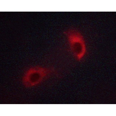 Phospho-Lck (Tyr393)[Tyr394] Antibody - AF3101 staining Jurkat cells by ICC/IF.