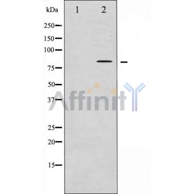 Phospho-Tau (Thr181)[Thr498] Antibody - Western blot analysis of extracts from Mouse brain tissue, using Phospho-Tau (Thr181) Antibody.