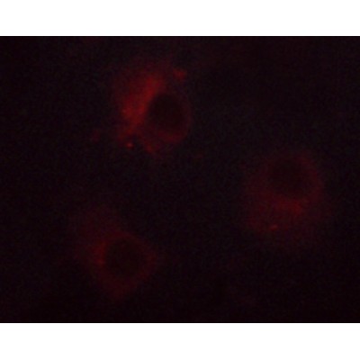 Phospho-NCF1/p47-phox (Ser359) Antibody - AF3167 staining RL cells  by ICC/IF.