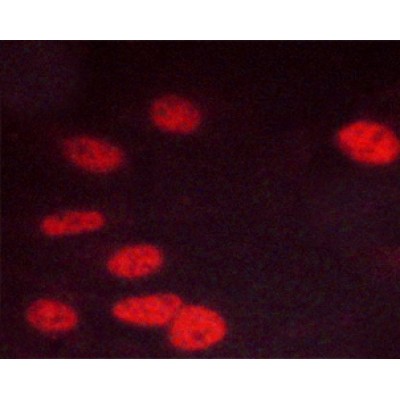Phospho-CDK1/CDC2 (Thr14) Antibody - AF3236 staining C6 cells by ICC/IF.