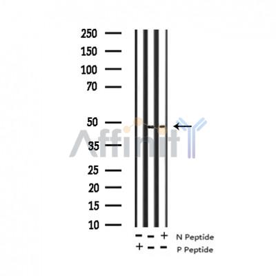 Phospho-CXCR2 (Ser347) Antibody - Western blot analysis of Phospho-IL-8R beta/CDw128 beta (Ser347) expression in Mouse kidney lysate.