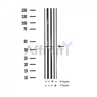 Phospho-MARCKS (Ser159) Antibody - Western blot analysis of Phospho-MARCKS (Ser158) Antibody expression in mouse heart and rat lung tissues lysates.