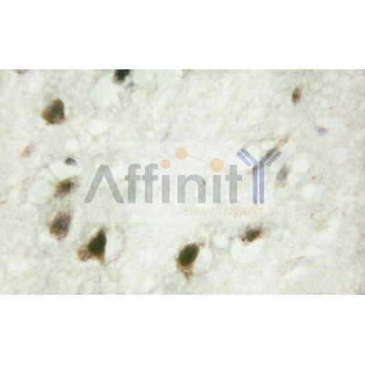 NR3C1 Antibody - AF6066 at 1/100 staining human brain tissue by IHC-P.
