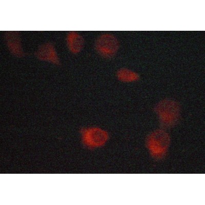 Lck Antibody - AF6100 staining MCF-7 cells by ICC/IF.