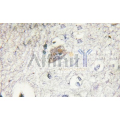 VHL Antibody - AF6292 at 1/100 staining mouse kidney tissue by IHC-P.