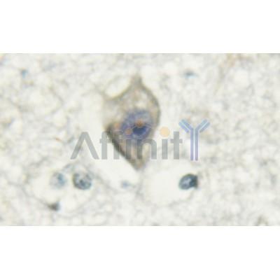 Calmodulin1/2/3 Antibody - AF6353 at 1/100 staining human brain tissue by IHC-P.