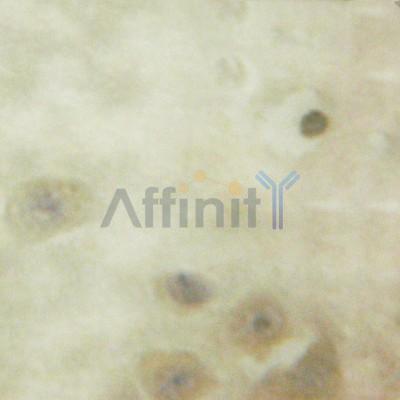 CaMKII beta/ gamma/ delta Antibody - AF6434 at 1/100 staining human brain tissue by IHC-P.