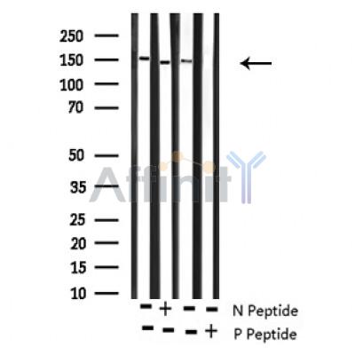 Phospho-ROCK2 (Tyr722) Antibody - Western blot analysis of Phospho-ROCK2 (Tyr722) antibody expression in Rat brain and mouse lung tissues lysates.