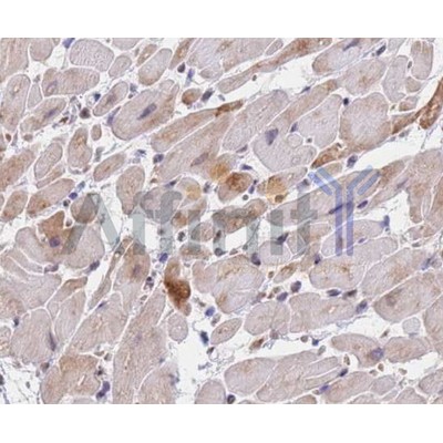 Smad9 Antibody - AF5114 at 1/100 staining human skin tissue by IHC-P.