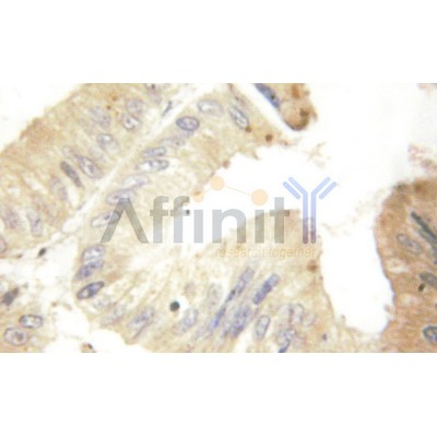 VEGFA Antibody - AF5131 at 1/100 staining human colon  tissue by IHC-P.