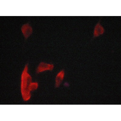 PERK Antibody - AF5304 staining lovo cells by ICC/IF.