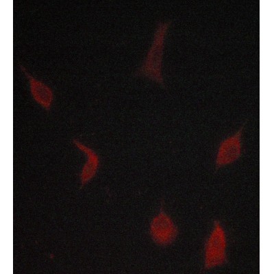 TGFBR1 Antibody - AF5347 staining lovo cells by ICC/IF.
