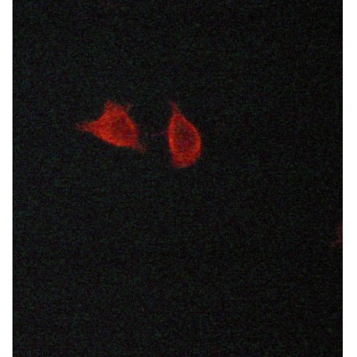 LC3A/B Antibody - AF5402 staining lovo cells by ICC/IF.