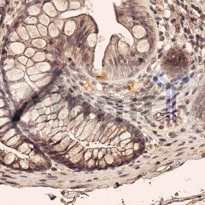 Collagen III Antibody - This image is a courtesy of anonymous review.