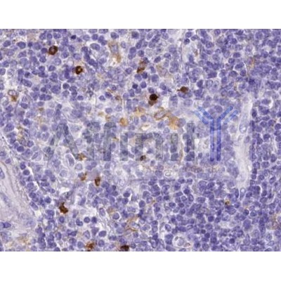 MMP9 Antibody - AF0220 at 1/100 staining Mouse liver tissue by IHC-P.