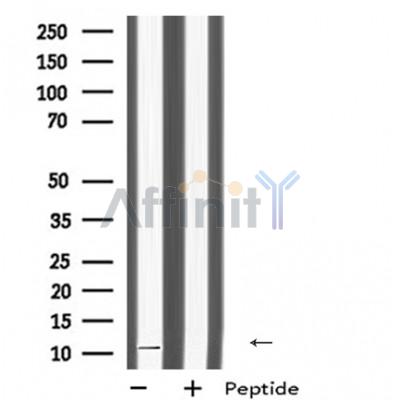 DAP Antibody - Western blot analysis of DAP using COLO205 whole cell lysates.