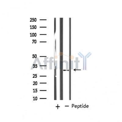 MARCKS Antibody - Western blot analysis of MARCKS expression in Mouse brain tissue lysates,The lane on the left was treated with the antigen-specific peptide.