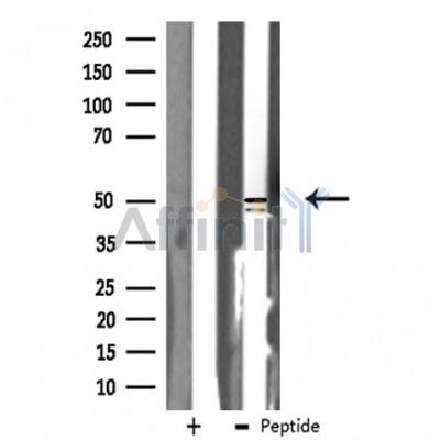 hnRNP H Antibody - Western blot analysis of extracts from Jurkat cells using hnRNP H antibody.
