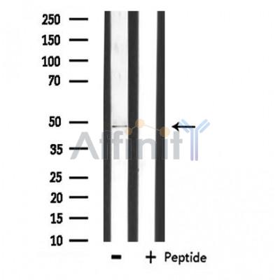 PLCH Antibody - Western blot analysis of extracts from Jurkat cells using PLCH antibody.